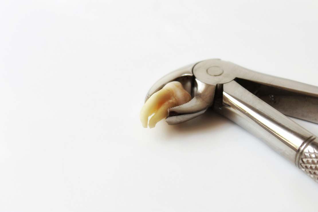 Po co nam zęby mądrości?