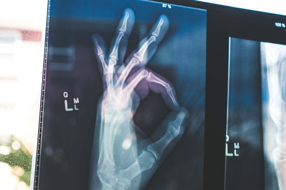 Blizny u dzieci - czy z wiekiem będą stawać się większe?